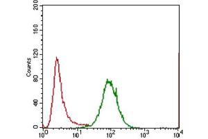 Immunohistochemical analysis of paraffin-embedded lung cancer tissues using IL3RA antibody with DAB staining. (IL3RA antibody  (AA 200-305))