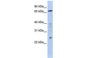 Image no. 1 for anti-Zinc Finger Protein 510 (ZNF510) (AA 611-660) antibody (ABIN6740579)