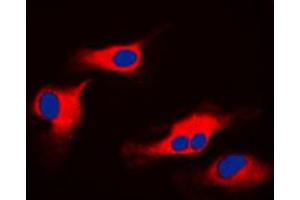 Immunofluorescent analysis of ORAOV1 staining in HeLa cells. (ORAOV1 antibody  (Center))