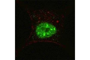 Fluorescent confocal image of SY5Y cells stained with p-STAT3 antibody at 1:200. (STAT3 antibody  (pSer727))