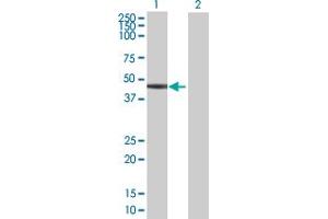 Western Blot analysis of SERPINB6 expression in transfected 293T cell line by SERPINB6 MaxPab polyclonal antibody. (SERPINB6 antibody  (AA 1-376))