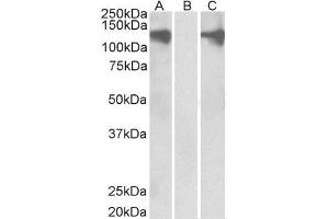HEK293 lysate (10ug protein in RIPA buffer) overexpressing Human PUM2 with DYKDDDDK tag probed with ABIN2564820 (0. (PUM2 antibody  (Internal Region))