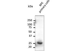 Western Blotting (WB) image for anti-RAB31, Member RAS Oncogene Family (RAB31) (C-Term) antibody (ABIN6254190) (RAB31 antibody  (C-Term))