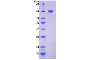 SDS-PAGE analysis of Human SSA2 Protein. (TROVE2 Protein)