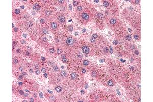 Anti-SAA1 / Serum Amyloid A antibody IHC of human liver. (SAA1 antibody)