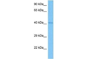Host:  Rat  Target Name:  TSG101  Sample Tissue:  Rat Brain  Antibody Dilution:  1ug/ml (TSG101 antibody  (C-Term))