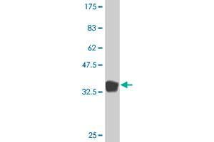 Western Blot detection against Immunogen (36. (PROS1 antibody  (AA 419-516))