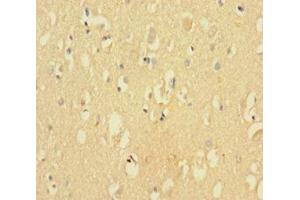 Immunohistochemistry of paraffin-embedded human brain tissue using ABIN7148873 at dilution of 1:100 (CDK2AP2 antibody  (AA 1-126))