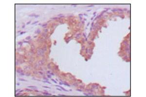 Immunohistochemistry (IHC) image for anti-Prostate Specific Antigen (PSA) (AA 26-251) antibody (ABIN2983296) (Prostate Specific Antigen antibody  (AA 26-251))