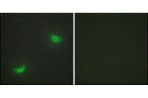 Immunofluorescence analysis of HepG2 cells, using DUSP16 antibody. (DUSP16 antibody  (C-Term))