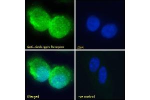 ABIN185266 Immunofluorescence analysis of paraformaldehyde fixed U2OS cells, permeabilized with 0. (Androgen Receptor antibody  (N-Term))