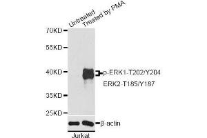 Western blot analysis of extracts of Jurkat cells, using Phospho-ERK1-T202/Y204 + ERK2-T185/Y187 antibody. (ERK1 antibody  (pThr185, pThr187, pThr202, pThr204))