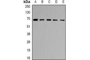 Western blot analysis of Ribophorin-2 expression in Jurkat (A), MCF7 (B), NIH3T3 (C), mouse liver (D), rat liver (E) whole cell lysates. (Ribophorin II antibody)