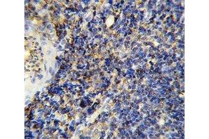 Immunohistochemistry (IHC) image for anti-Protein tyrosine Phosphatase, Receptor Type, C (PTPRC) (AA 1245-1275) antibody (ABIN3032401)