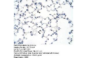 Mouse Kidney (MYBBP1A antibody  (C-Term))
