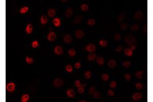 ABIN6266825 staining HuvEc by IF/ICC. (MAF antibody  (C-Term))