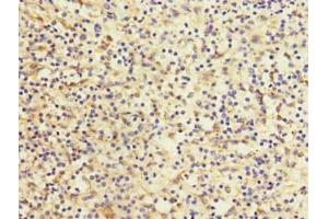 Immunohistochemistry of paraffin-embedded human spleen tissue using ABIN7158638 at dilution of 1:100 (LY75/DEC-205 antibody  (AA 440-680))