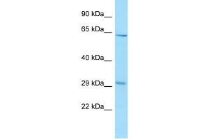 WB Suggested Anti-REEP3 Antibody Titration: 1. (REEP3 antibody  (C-Term))