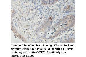 Image no. 1 for anti-Akirin 2 (AKIRIN2) antibody (ABIN1574568) (AKIRIN2 antibody)