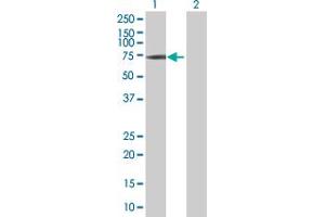 Lane 1: IFNAR1 transfected lysate ( 61.
