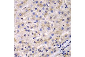 Immunohistochemistry (IHC) image for anti-Eukaryotic Translation Elongation Factor 2 (EEF2) (AA 1-290) antibody (ABIN3022843) (EEF2 antibody  (AA 1-290))