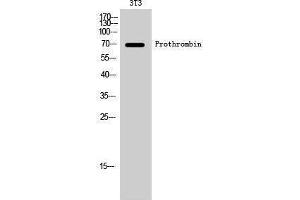 Western Blotting (WB) image for anti-Coagulation Factor II (thrombin) (F2) (Internal Region) antibody (ABIN3186562) (Prothrombin antibody  (Internal Region))