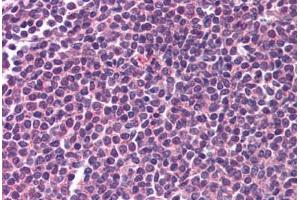 Human Spleen (formalin-fixed, paraffin-embedded) stained with RELA antibody ABIN218583 at 1:500 followed by biotinylated goat anti-rabbit IgG secondary antibody ABIN481713, alkaline phosphatase-streptavidin and chromogen. (NF-kB p65 antibody  (C-Term))