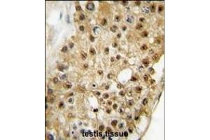 Formalin-fixed and paraffin-embedded human testis tissue reacted with ELP3 antibody (C-term) (ABIN387967 and ABIN2844715) , which was peroxidase-conjugated to the secondary antibody, followed by DAB staining. (ELP3/KAT9 antibody  (C-Term))