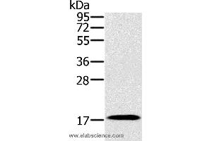 Western blot analysis of Mouse heart tissue, using RNF122 Polyclonal Antibody at dilution of 1:300 (RNF122 antibody)