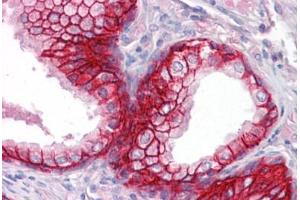 Anti-EPCAM antibody IHC staining of human prostate. (EpCAM antibody)