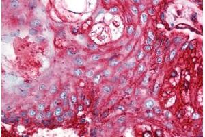 Human Skin, Pilosebaceous Unit (formalin-fixed, paraffin-embedded) stained with CD59 antibody ABIN298470 at 5 ug/ml followed by biotinylated anti-mouse IgG secondary antibody ABIN481714, alkaline phosphatase-streptavidin and chromogen. (CD59 antibody)