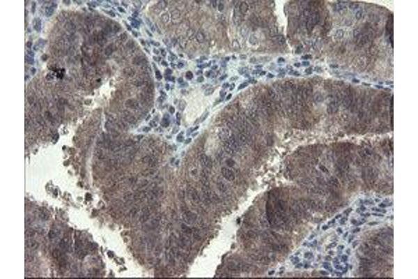 FBXO42 antibody  (AA 356-717)