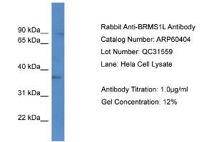 Western Blotting (WB) image for anti-Breast Cancer Metastasis-Suppressor 1-Like (BRMS1L) (C-Term) antibody (ABIN2788437) (BRMS1L antibody  (C-Term))