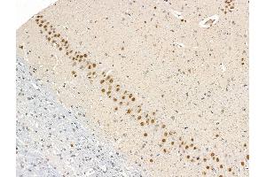 ABIN7094818 and ABIN7098869 at 1/100 staining Rat brain tissue by IHC-P.
