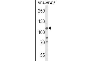 Western blot analysis of JMJD2B- (ABIN653576 and ABIN2842951) in MDA-M cell line lysates (35 μg/lane). (KDM4B antibody  (AA 281-306))
