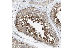 Immunohistochemical staining of human testis with KLHDC10 polyclonal antibody  shows strong cytoplasmic positivity in cells of the seminiferus ducts at 1:50-1:200 dilution.