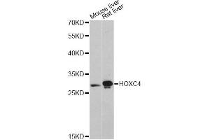 Western blot analysis of extracts of various cell lines, using HOXC4 antibody (ABIN6291154) at 1:3000 dilution.