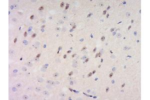 Formalin-fixed and paraffin embedded rat brain labeled with Anti-GDNFRA Polyclonal Antibody, Unconjugated  at 1:200 followed by conjugation to the secondary antibody and DAB staining.