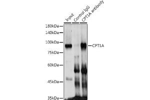 Immunofluorescence analysis of NIH/3T3 cells using CPT1A Rabbit pAb (ABIN6130129, ABIN6138976, ABIN6138977 and ABIN6220929) at dilution of 1:100 (40x lens). (CPT1A antibody  (AA 497-756))