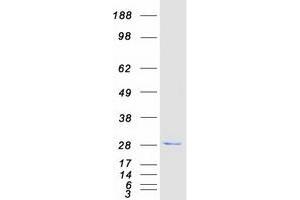 Validation with Western Blot (ATG101 Protein (Transcript Variant 1) (Myc-DYKDDDDK Tag))