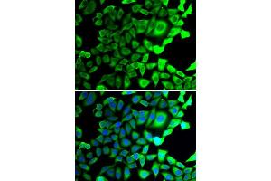 Immunofluorescence analysis of A549 cells using USP8 antibody (ABIN5974228).