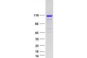 Validation with Western Blot (ARHGEF1 Protein (Transcript Variant 1) (Myc-DYKDDDDK Tag))