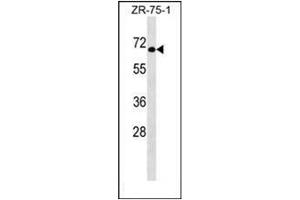Western blot analysis of GTF3C5 Antibody (Center) in ZR-75-1 cell line lysates (35ug/lane). (GTF3C5 antibody  (Middle Region))