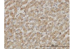 Image no. 1 for anti-DEAD (Asp-Glu-Ala-Asp) Box Polypeptide 56 (DDX56) (AA 450-548) antibody (ABIN599259) (DDX56 antibody  (AA 450-548))