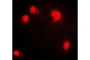 Immunofluorescent analysis of PRMT5 staining in HepG2 cells.