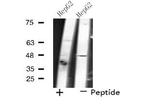 Western blot analysis of extracts from HepG2 cells, using SLC17A2 antibody. (SLC17A2 antibody  (N-Term))