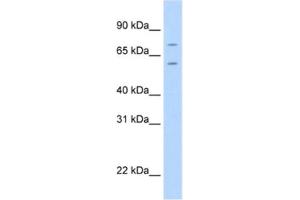 Western Blotting (WB) image for anti-Forkhead Box K1 (Foxk1) antibody (ABIN2461563) (Foxk1 antibody)