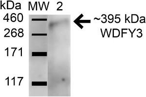 Western blot analysis of Human HeLa and 293Trap cell lysates showing detection of 395. (WDFY3 antibody  (AA 533-544) (PerCP))