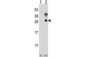 Western Blotting (WB) image for anti-Kallikrein 7 (KLK7) antibody (ABIN5022445) (Kallikrein 7 antibody)