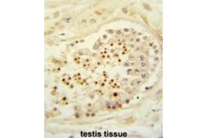 Immunohistochemistry (IHC) image for anti-Cbl Proto-Oncogene B, E3 Ubiquitin Protein Ligase (CBLB) antibody (ABIN3003861) (Cbl Proto-Oncogene B, E3 Ubiquitin Protein Ligase (CBLB) antibody)